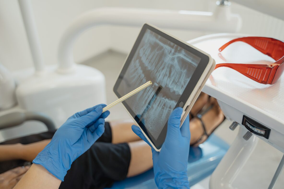 What Does a Periodontist Do | Village Periodontics